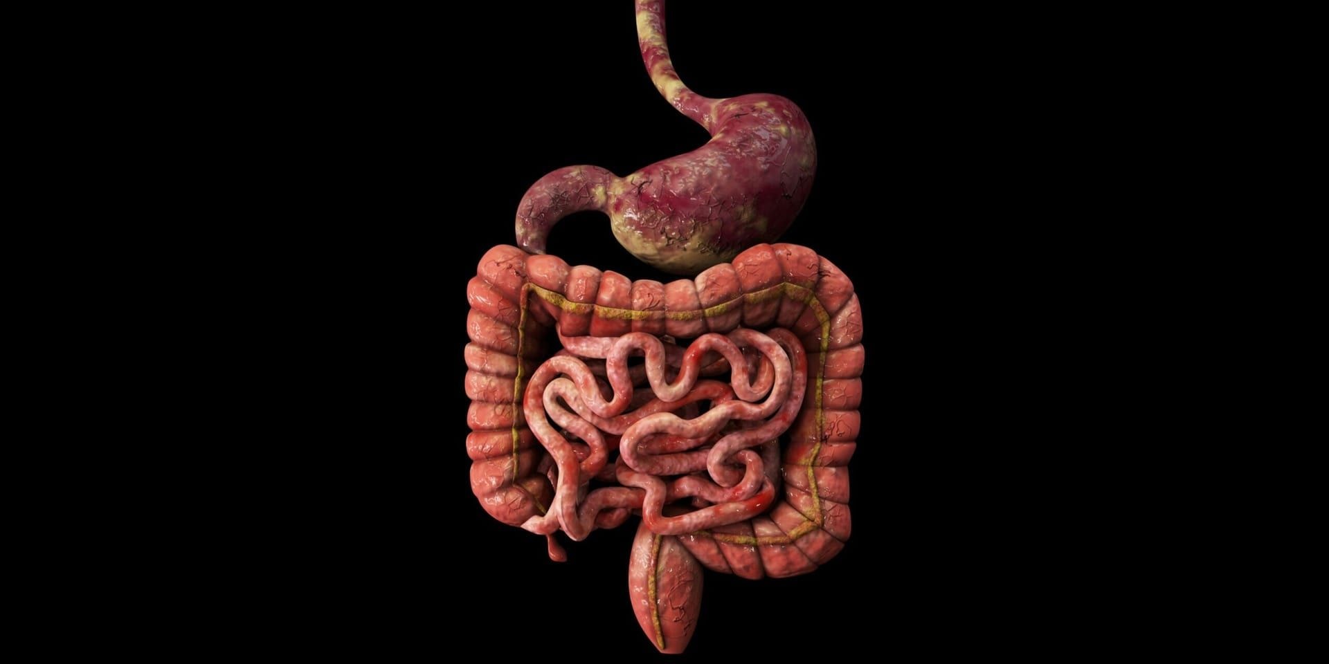 NIH Reports on Breakthroughs in Miniature Organs and Psoriasis Research