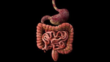 NIH Reports on Breakthroughs in Miniature Organs and Psoriasis Research