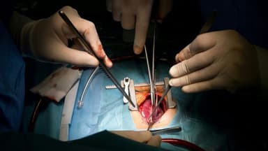 Scientists Map Human Immune Response to Pig Kidney Transplants