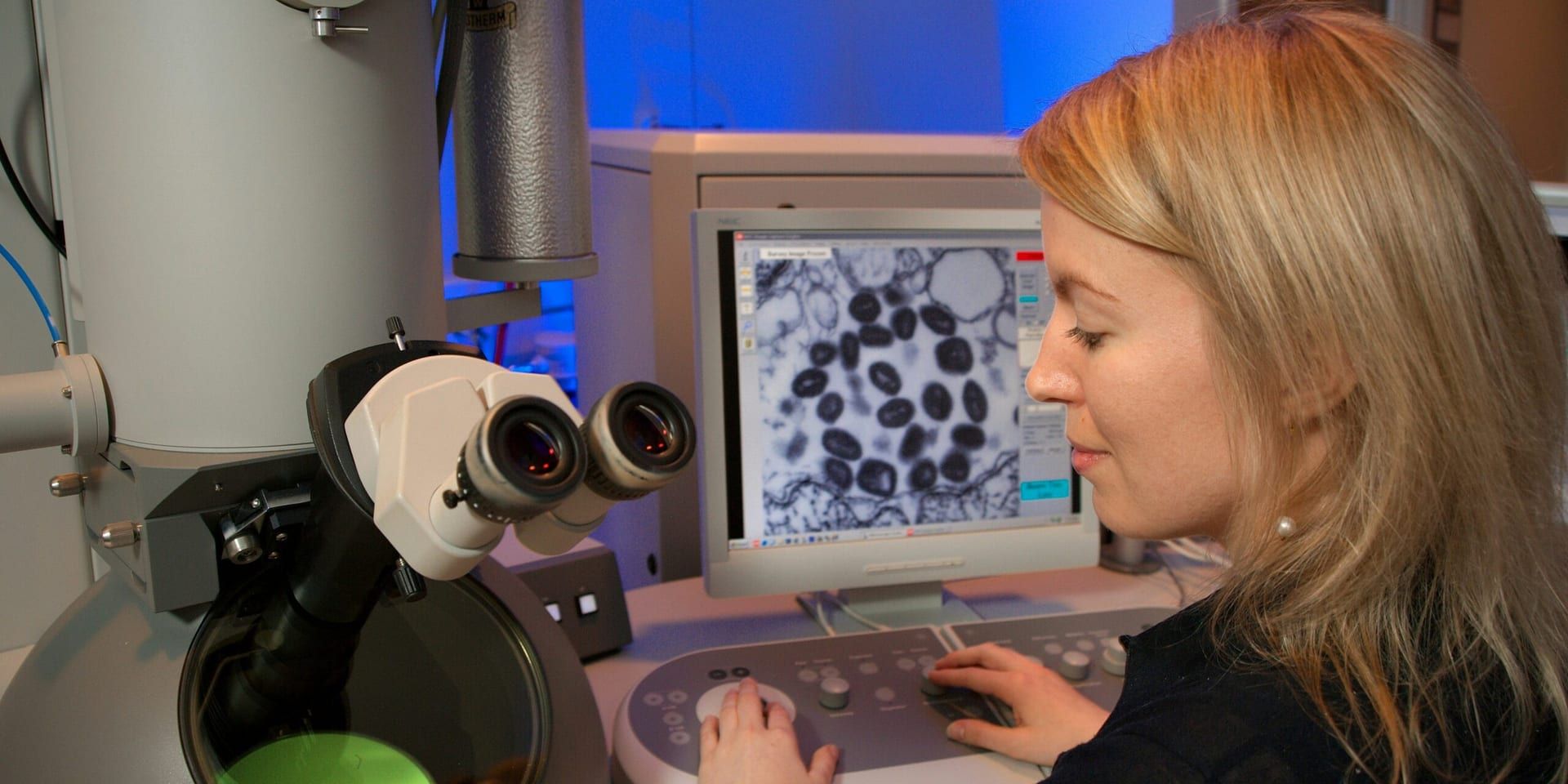 NIH Highlights Advanced MRI for Microscopic Brain Mapping