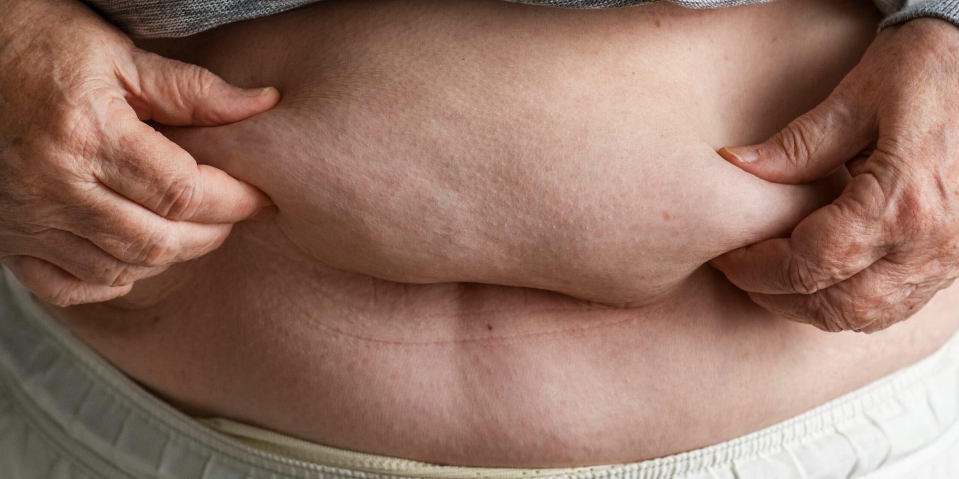 Study Links High-Fat Diets to Rapid Gut Health Decline