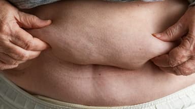Study Links High-Fat Diets to Rapid Gut Health Decline