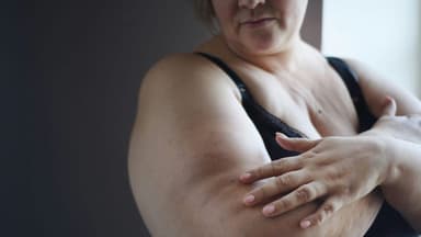 Wave Life Sciences Schedules Release of Interim Trial Data for Obesity Treatment Candidate