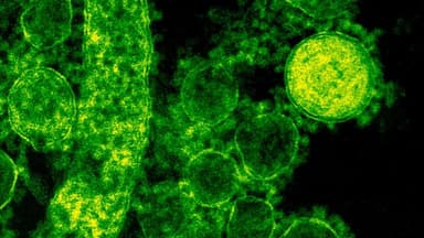 Florida’s Measles Outbreak Raises Alarm for Public Health Safety