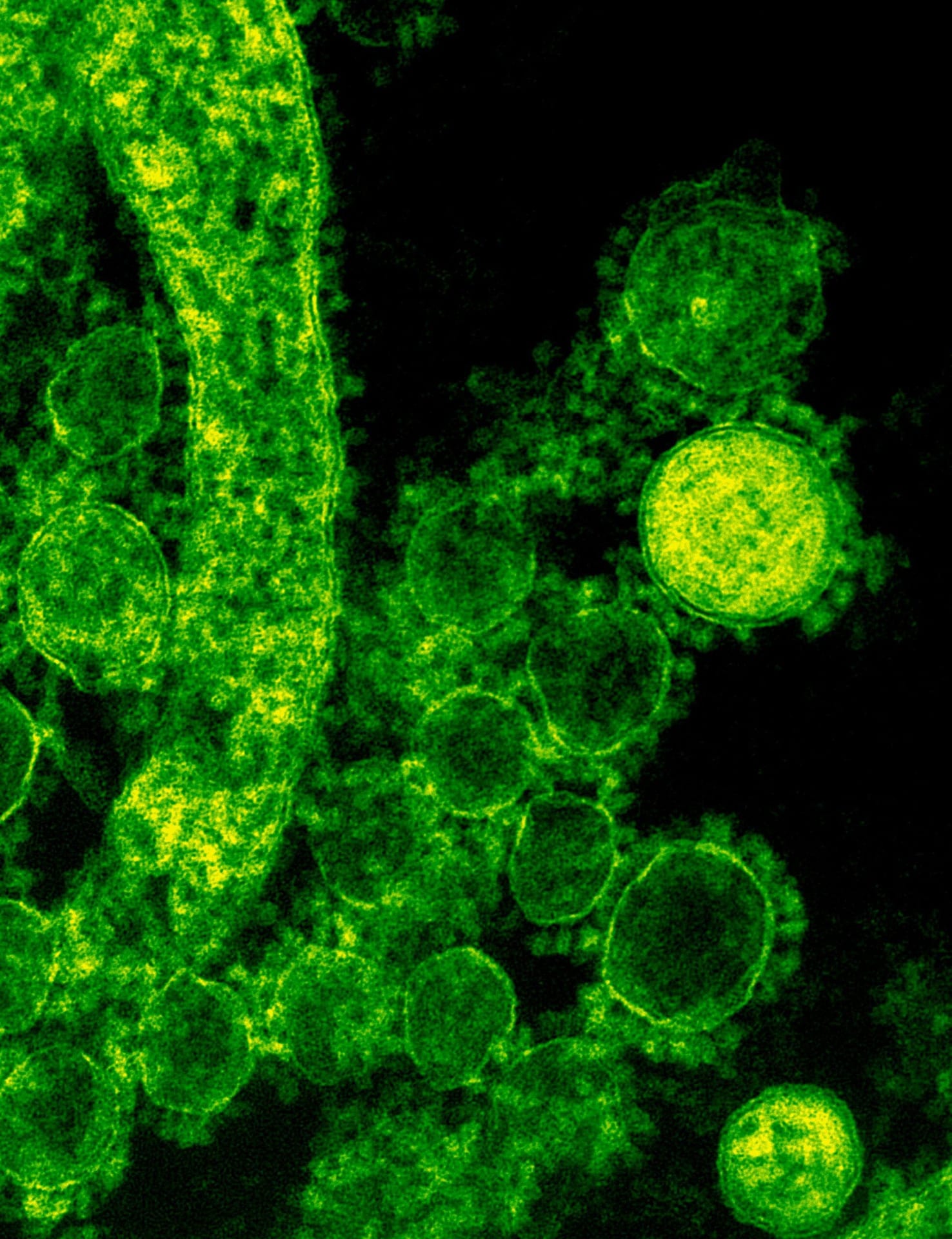 Florida’s Measles Outbreak Raises Alarm for Public Health Safety