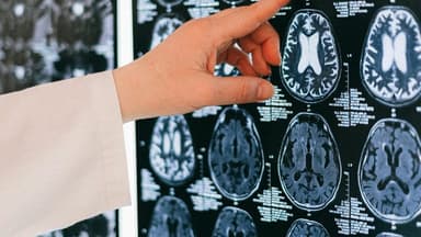Neuralink Reaches Major Milestone: First Successful Human Brain-Computer Interface Implant